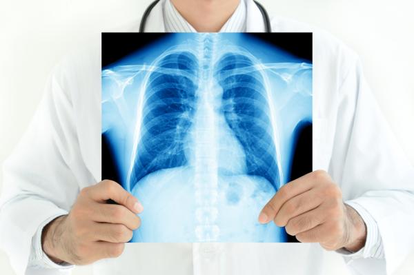 Ursachen von Flecken in der Lunge