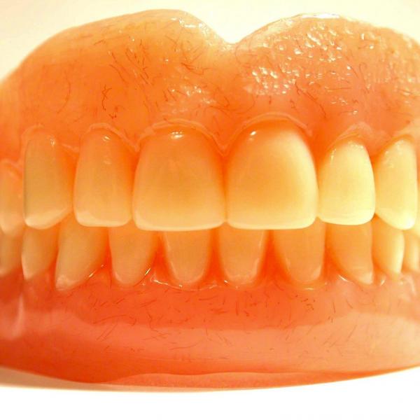 Wie man Kleber auf Zahnprothesen anwendet