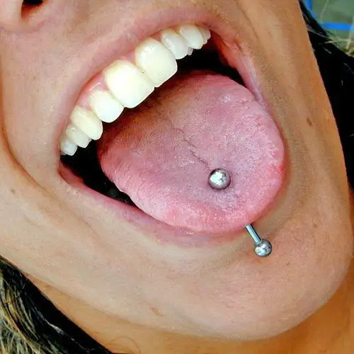 Wie man ein infiziertes Piercing in der Zunge heilt