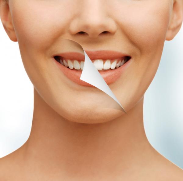 Wie man Zahnbelag entfernt