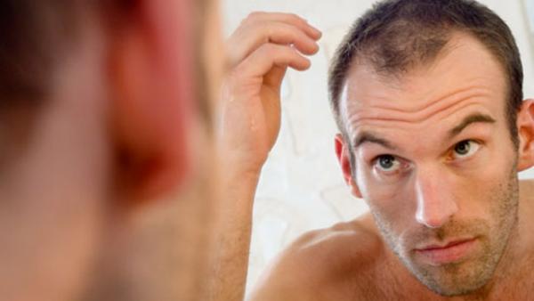 Wie man Haarverlust vermeidet