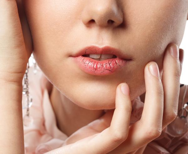 Wie man trockene Haut von den Lippen entfernt