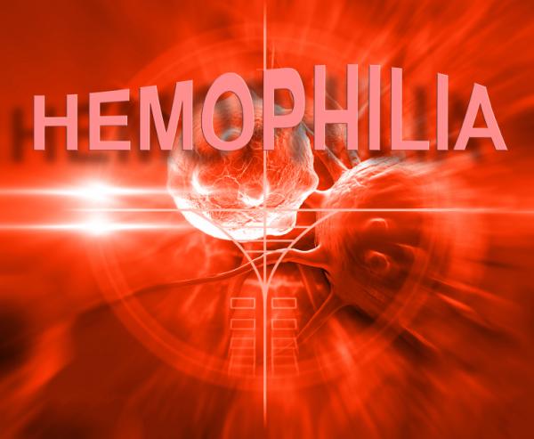 Wie kann ich wissen, ob ich Hämophilie habe?