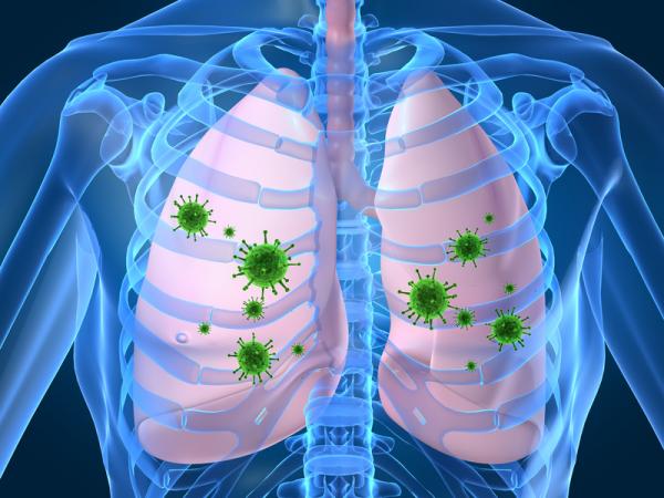 Wie Lungenentzündung verbreitet wird