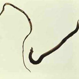 Wie Schistosomiasis übertragen wird