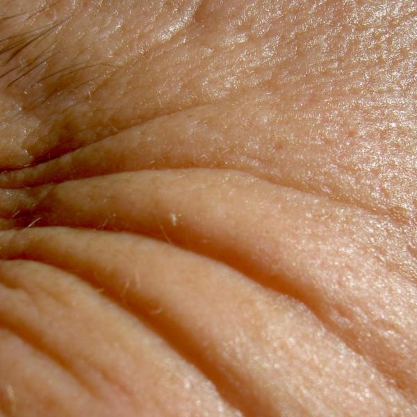 Wie behandelt man die Haut mit Dekubitusgeschwüren