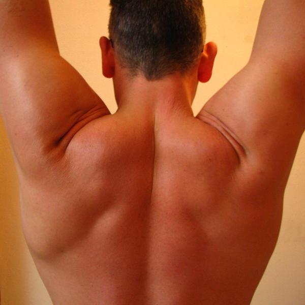 Wie behandelt man Rückenschmerzen?