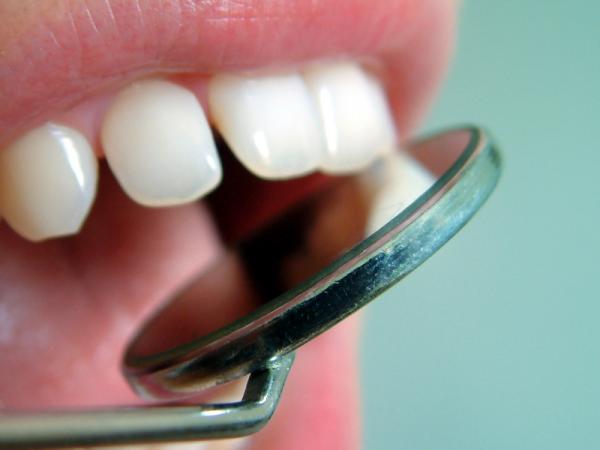Wie man die getrennten Zähne verkleidet