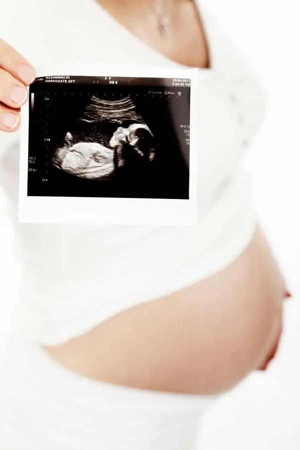 Was ist der Unterschied zwischen Zygote und Embryo?