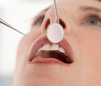 Was sind die Symptome einer oralen Candidose?