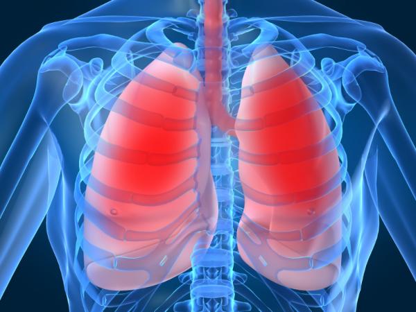 Was sind die Symptome einer Lungenentzündung?