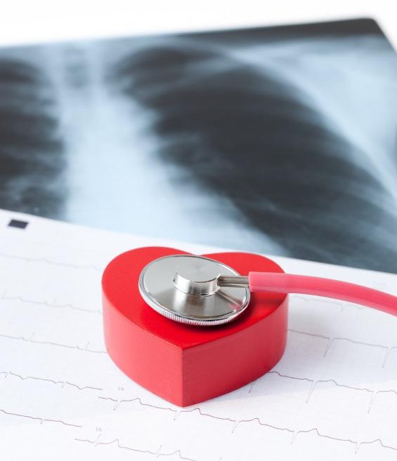 Was sind die Symptome einer Herzrhythmusstörung?