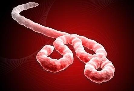 Was sind die Symptome von Ebola?