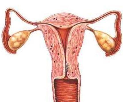Wie wirkt die intrauterine Insemination?