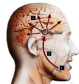 Wie Cluster-Kopfschmerz behandelt wird