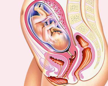 Wie sind die Komplikationen der Retroversion des trächtigen Uterus?