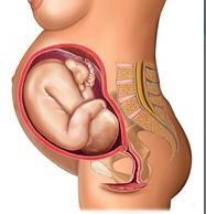 Wie behandelt man die Retroversion des trächtigen Uterus?