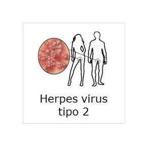 Was ist die Behandlung von Herpes genitalis