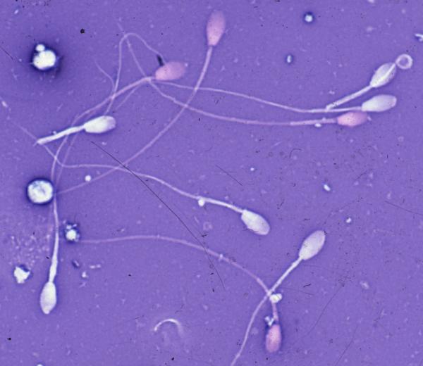 Wie schmeckt Sperma?