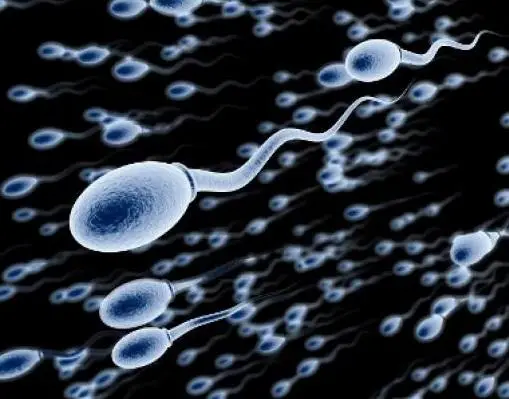 Wie Spermien gebildet werden