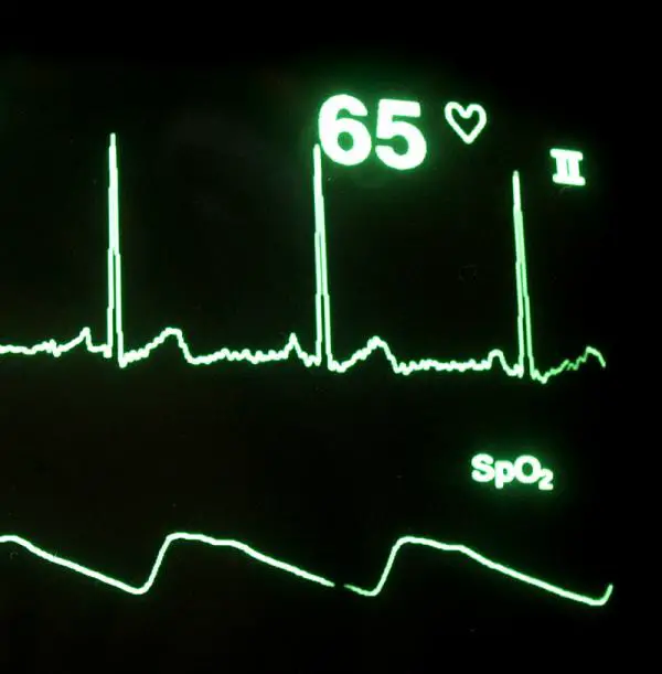 Wie man die Herzfrequenz kontrolliert