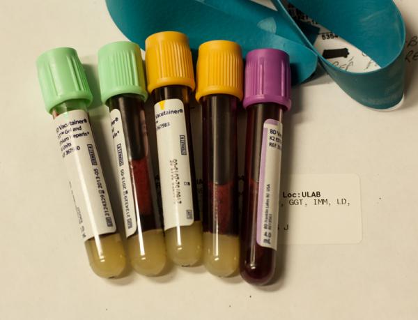 Was ist bei einem Bluttest erforderlich?