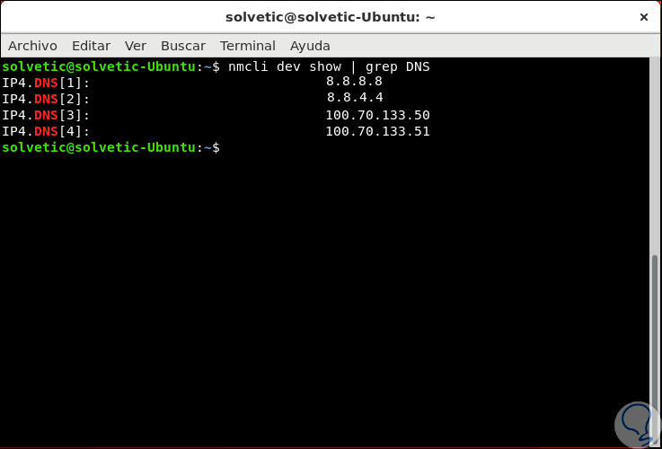 14-überprüfe-die-IP-Adressen-des-DNS-Servers.png